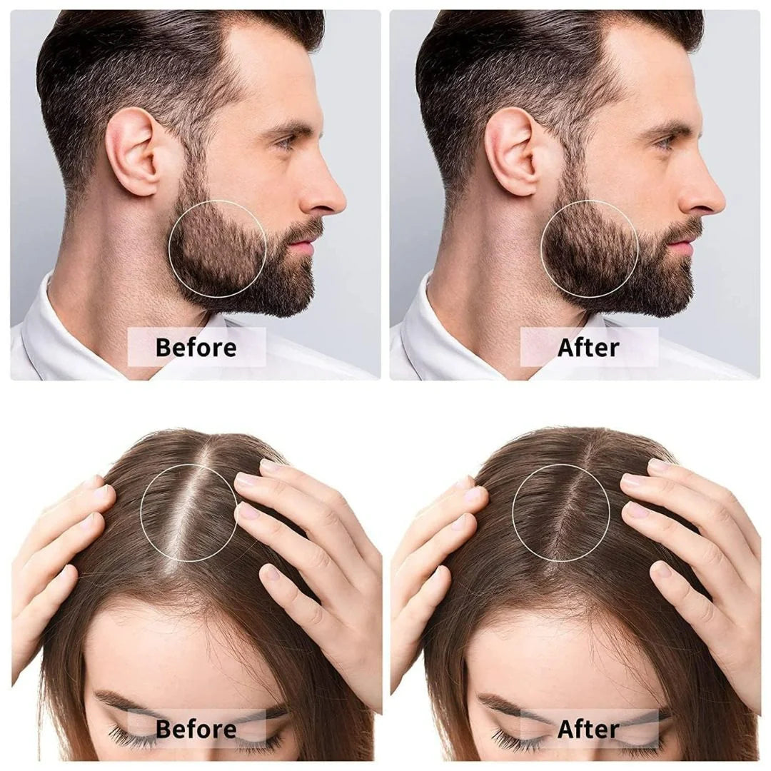Derma Roller For Hair & Beard Growth 0.5 mm
