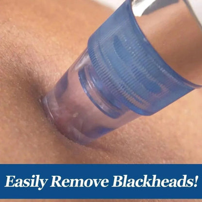 Blackhead Remover Vacuum Device with Suction Heads