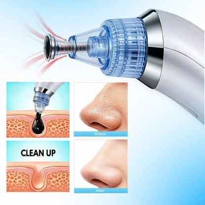 Blackhead Remover Vacuum Device with Suction Heads