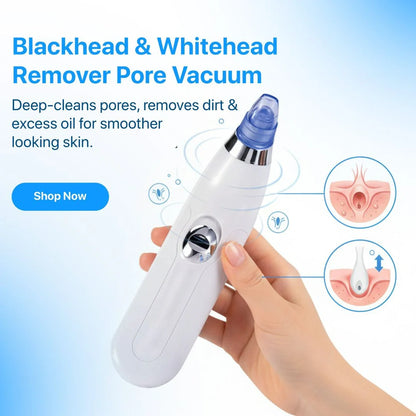 Blackhead Remover Vacuum Device with Suction Heads