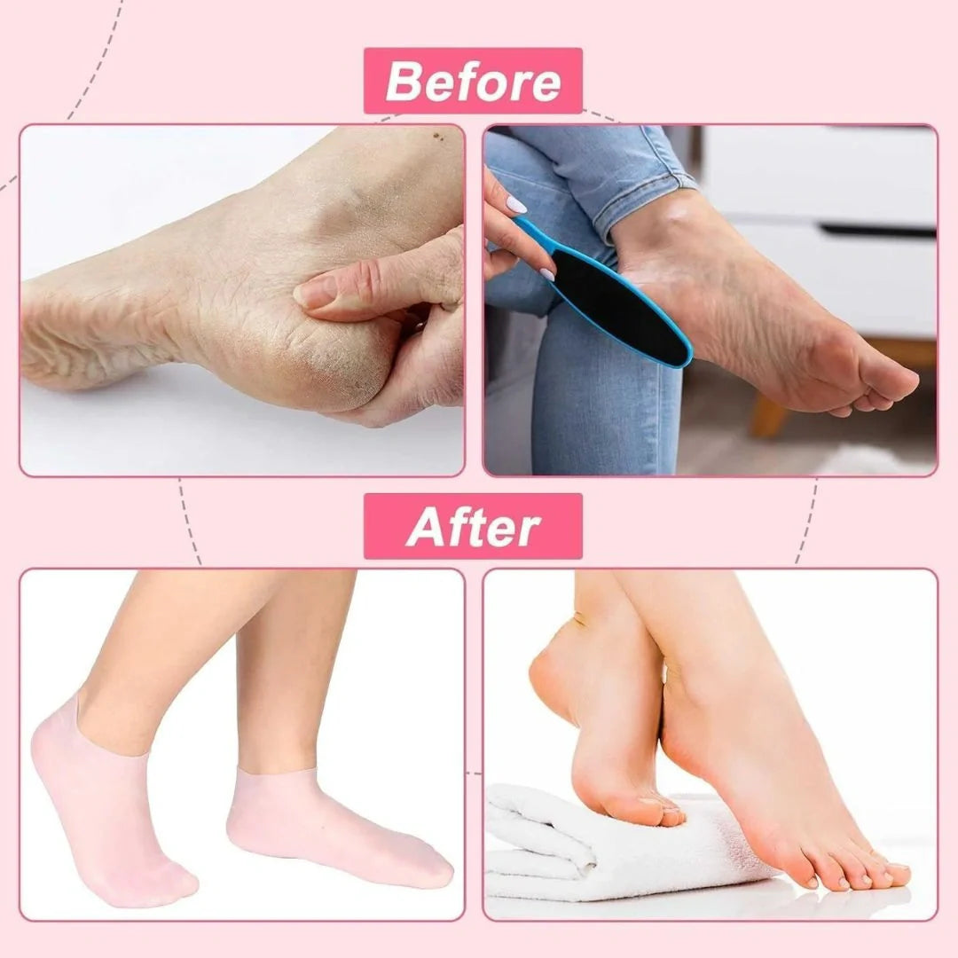 Silicone Gel Socks